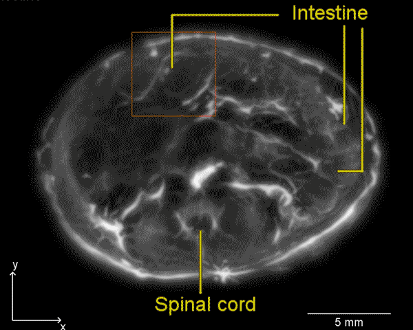 ͼΪ�ù������������ɵ�С�󳦵�ͼ��